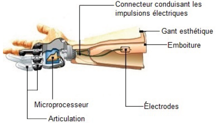 CCS-MP-2015-ProtheseMainMyoelectrique-Support